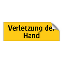 Verletzung der Hand
