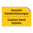 Vorsicht Handverletzungen - Caution Hand Injuries