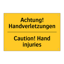 Achtung! Handverletzungen - Caution! Hand injuries
