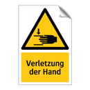 Verletzung der Hand