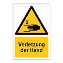 Verletzung der Hand